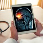 Wabah Meningitis di Inggris: Gejala Mirip Flu yang Berujung Fatal dan Jadi Peringatan Serius