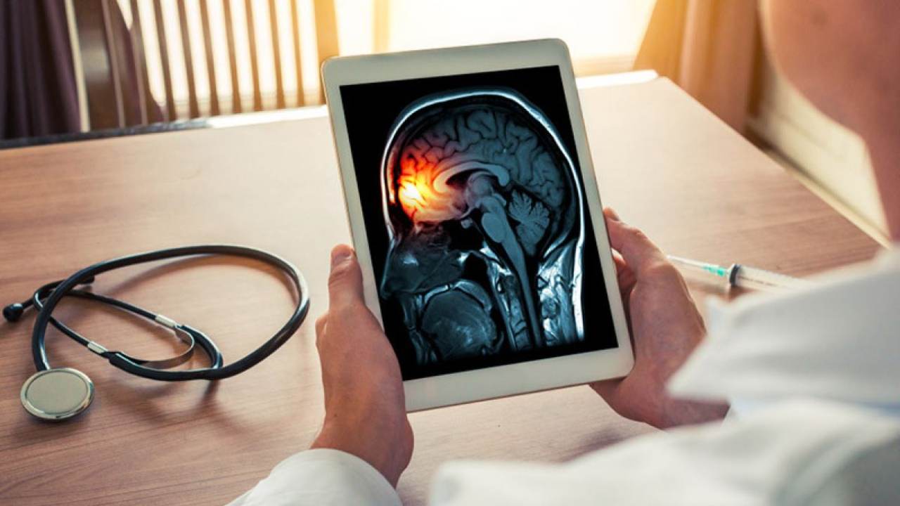 Wabah Meningitis di Inggris: Gejala Mirip Flu yang Berujung Fatal dan Jadi Peringatan Serius